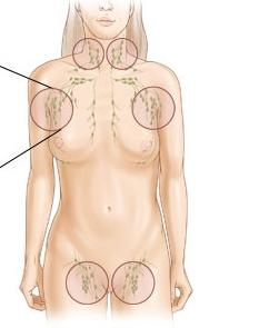 Защо лимфните възли в слабините при жените се възпаляват?