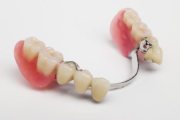Сменяема протеза на зъбите в нашето време